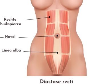 Diastase
